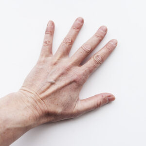 En hand på en vit bakgrund. 