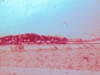 20151227_8w